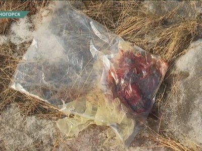 С кровавыми пакетами из роддома разбирается прокуратура 
