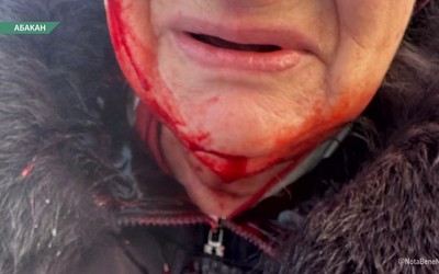 Пенсионерка в Абакане разбила голову на переходе через железную дорогу