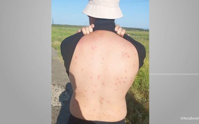 На сыпь и зуд пожаловались отдыхающие с Шунерского карьера