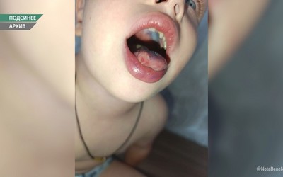 Развели дезинфицирующее средство не по СанПиНу в Подсинском детском саду