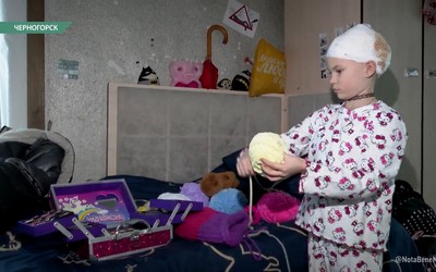 Уцелело только 20% тканей с волосяным покровом