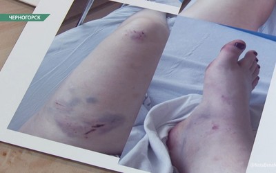 Пострадавшая при обрушении котельной в Черногорске до сих пор не может поправить своё здоровье