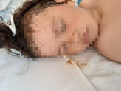 Могла выпрыгнуть из кузова: новая версия по пострадавшей девочке 
