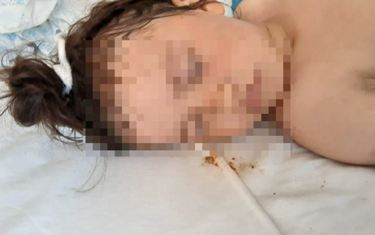 Могла выпрыгнуть из кузова: новая версия по пострадавшей девочке 