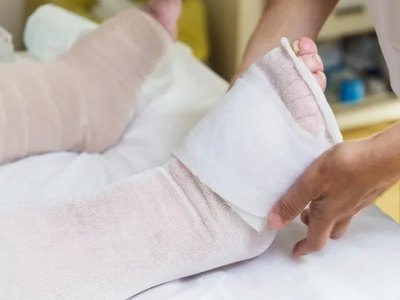 Житель Черногорска во сне сунул ногу в печь 