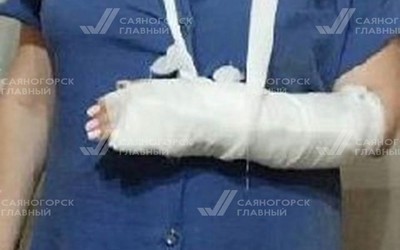 Домашняя собака напала на женщину в Саяногорске и перекусила ей руку
