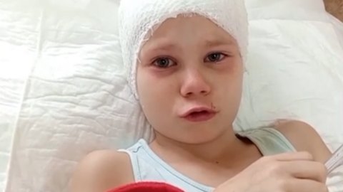 Первоклассница из Черногорска летит к московским врачам 3 декабря. На нее напала овчарка 