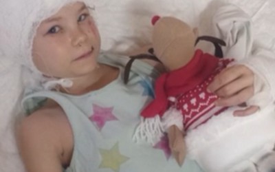 Первоклассницу из Черногорска после нападения овчарки прооперировали в Москве