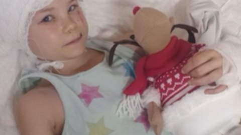 Первоклассницу из Черногорска после нападения овчарки прооперировали в Москве