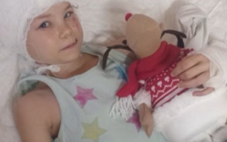 Первоклассницу из Черногорска после нападения овчарки прооперировали в Москве