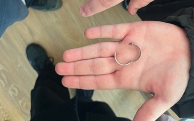 Спасатели разрезали кольцо на опухшем пальце 18-летней минусинки